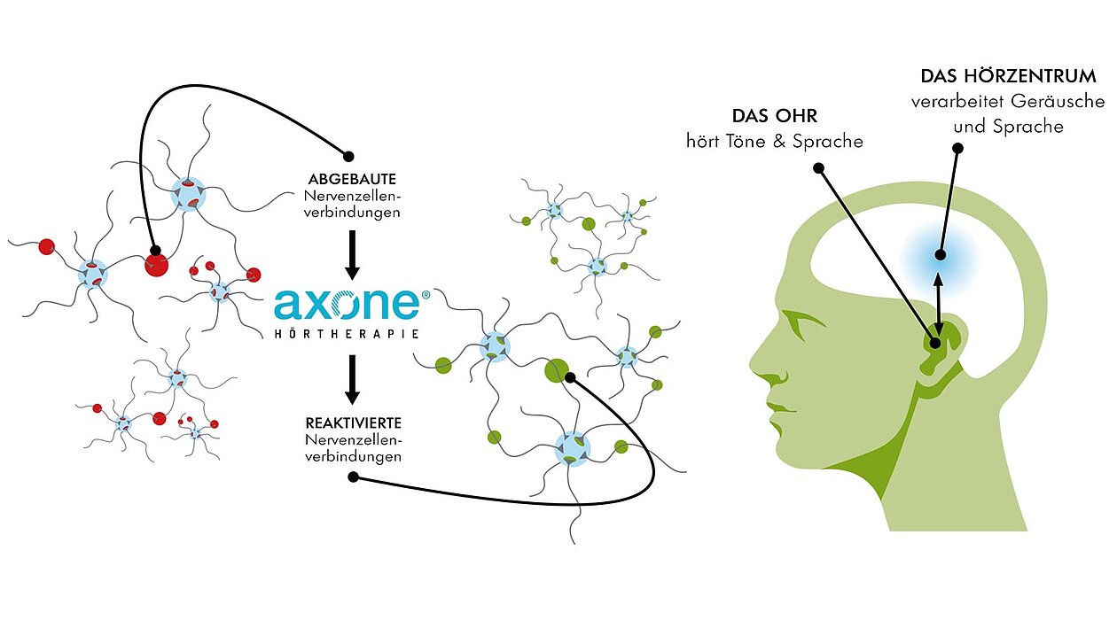 Axone-Hörtherapie-Grafik